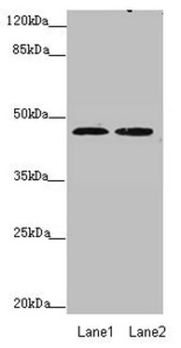 Western blot. All lanes: ZDHHC16 antibody at 0.89 ug/ml. Lane 1: MCF-7 whole cell lysate. Lane 2: HepG2 whole cell lysate. Secondary. Goat polyclonal to rabbit IgG at 1/10000 dilution. Predicted band size: 44, 42, 39, 35 kDa. Observed band size: 44 kDa. 