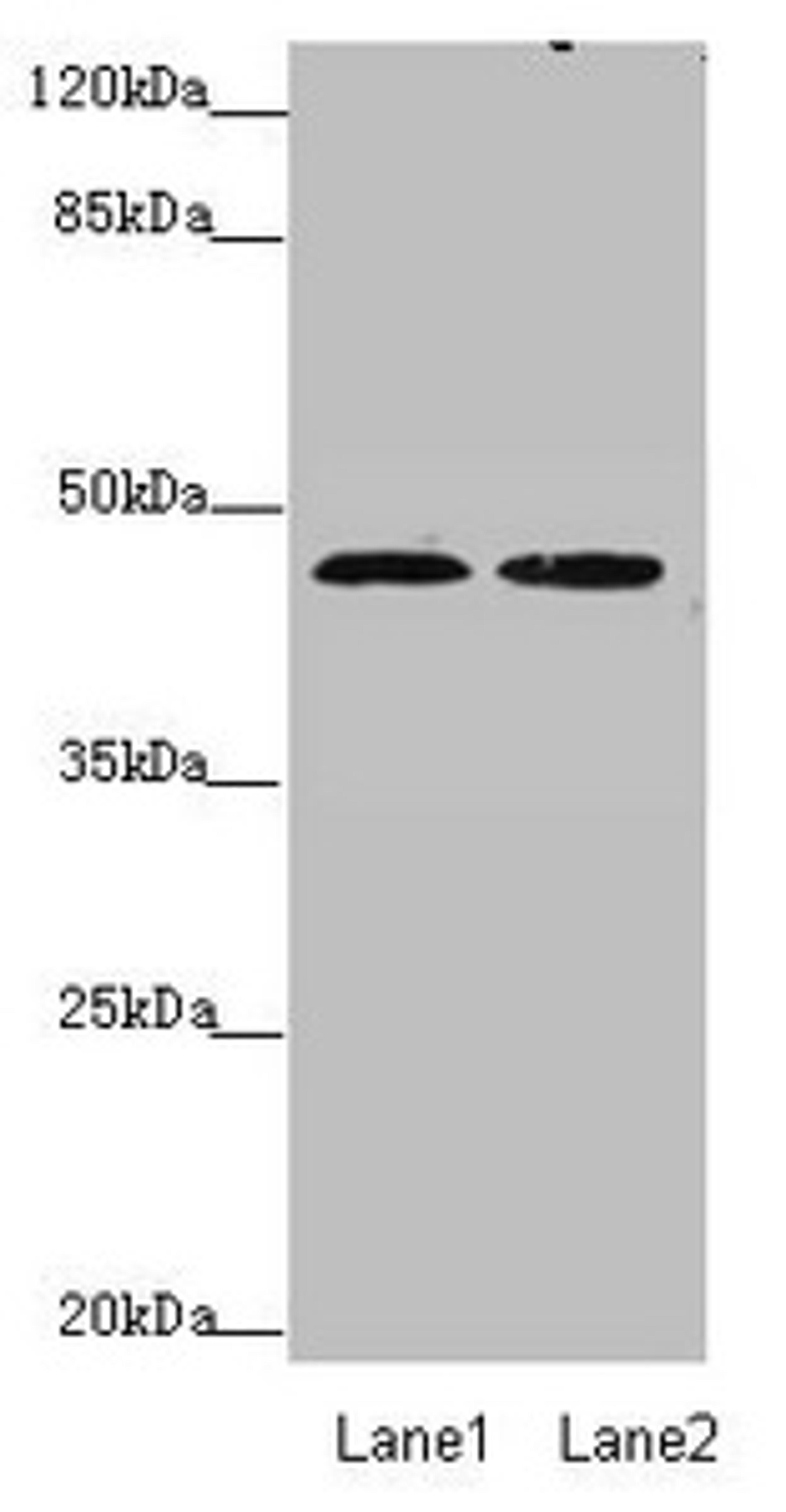 Western blot. All lanes: ZDHHC16 antibody at 0.89 ug/ml. Lane 1: MCF-7 whole cell lysate. Lane 2: HepG2 whole cell lysate. Secondary. Goat polyclonal to rabbit IgG at 1/10000 dilution. Predicted band size: 44, 42, 39, 35 kDa. Observed band size: 44 kDa. 
