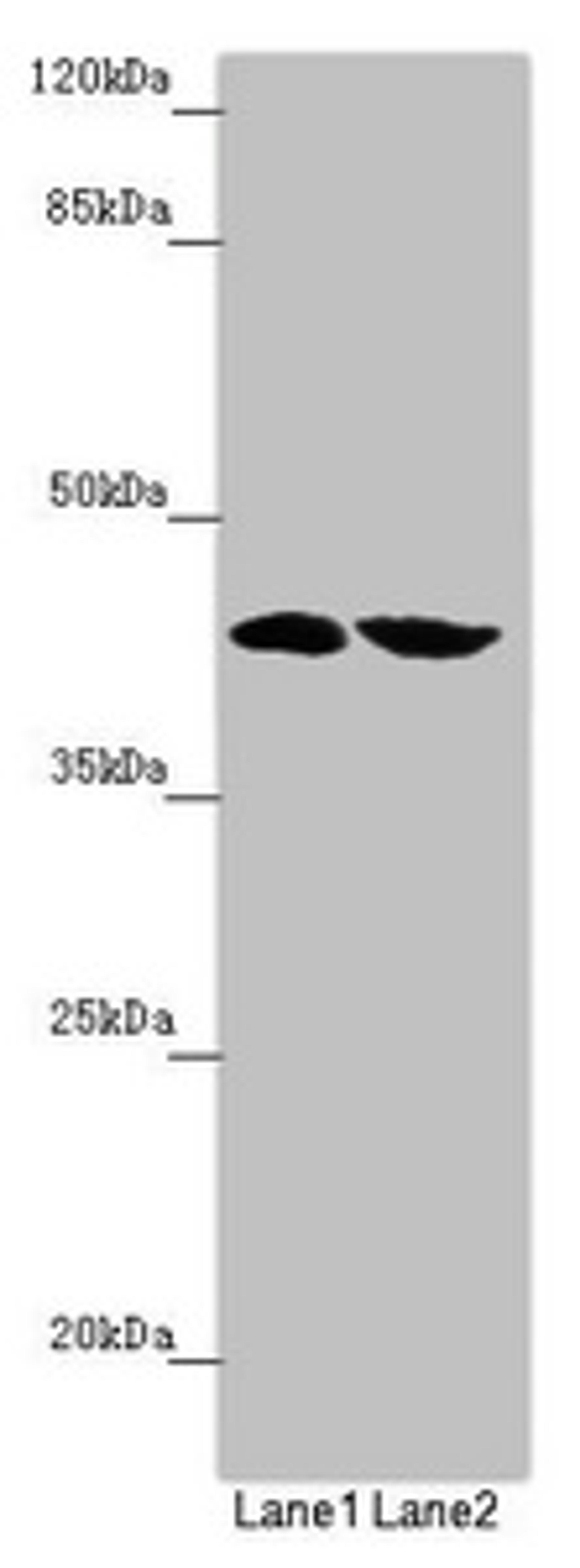 Western blot. All lanes: FBXO22 antibody at 2.42 ug/ml. Lane 1: Mouse heart tissue. Lane 2: Mouse liver tissue. Secondary. Goat polyclonal to rabbit IgG at 1/10000 dilution. Predicted band size: 45, 5, 31 kDa. Observed band size: 45 kDa. 