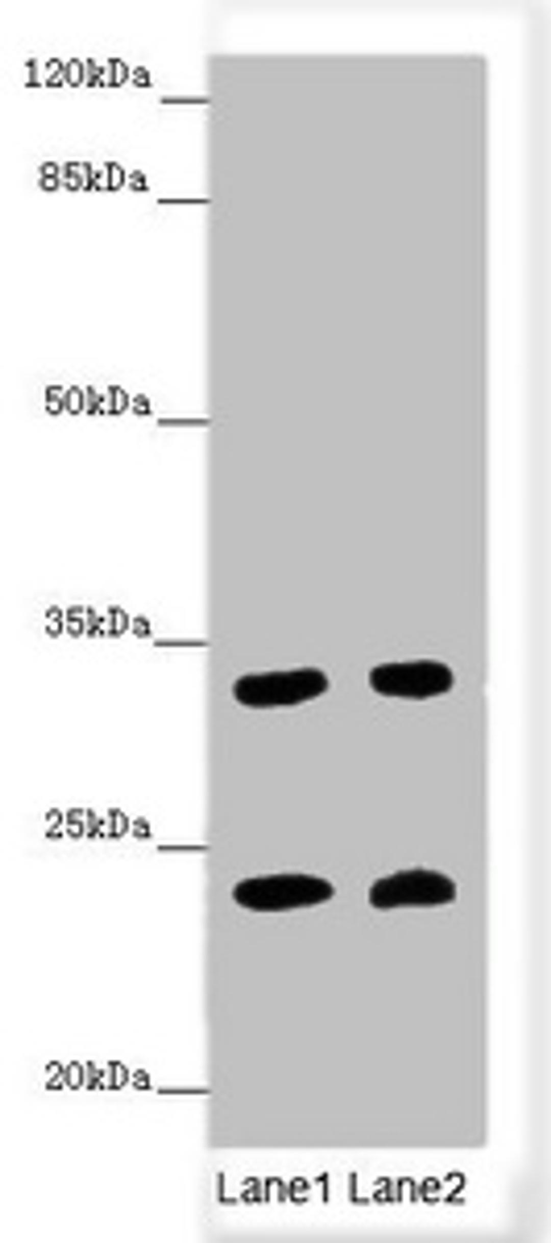 Western blot. All lanes: MRAS antibody at 3.44 ug/ml. Lane 1: Mouse brain tissue. Lane 2: Mouse heart tissue. Secondary. Goat polyclonal to rabbit IgG at 1/10000 dilution. Predicted band size: 24, 16 kDa. Observed band size: 24, 32 kDa. 
