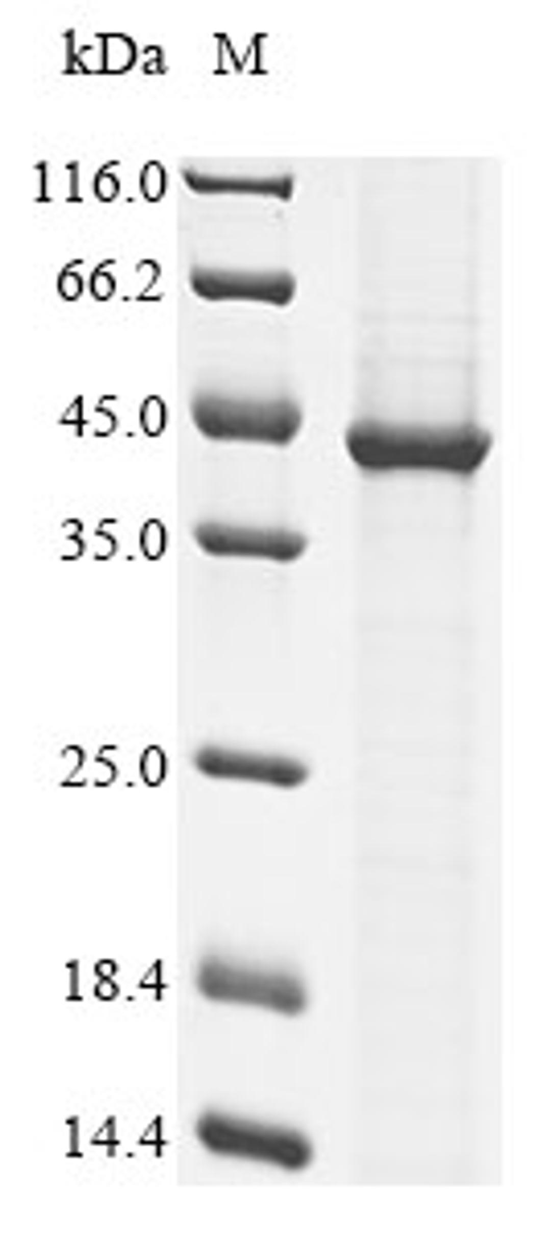 (Tris-Glycine gel) Discontinuous SDS-PAGE (reduced) with 5% enrichment gel and 15% separation gel.