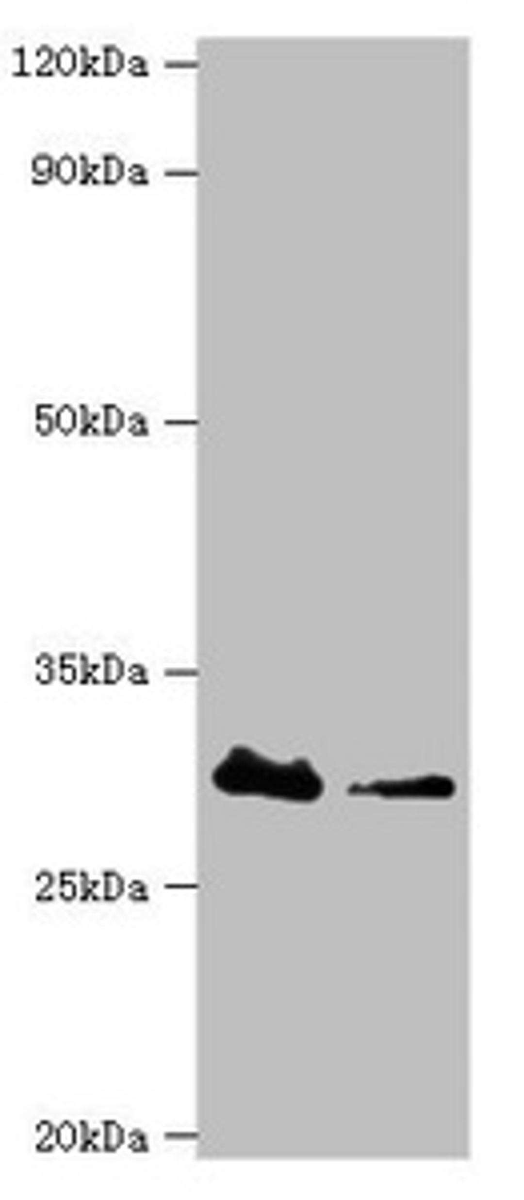 Western blot. All lanes: Carbonyl reductase [NADPH] 3 antibody at 10ug/ml. Lane 1: Hela whole cell lysate. Lane 2: K562 whole cell lysate. Secondary. Goat polyclonal to rabbit IgG at 1/10000 dilution. Predicted band size: 31 kDa. Observed band size: 31 kDa. 