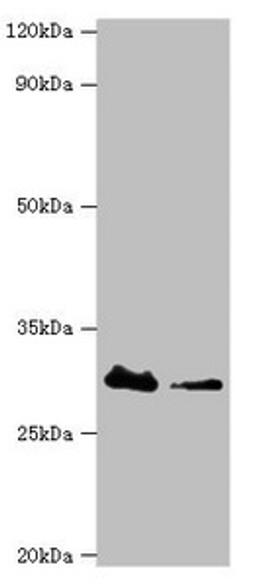 Western blot. All lanes: Carbonyl reductase [NADPH] 3 antibody at 10ug/ml. Lane 1: Hela whole cell lysate. Lane 2: K562 whole cell lysate. Secondary. Goat polyclonal to rabbit IgG at 1/10000 dilution. Predicted band size: 31 kDa. Observed band size: 31 kDa. 