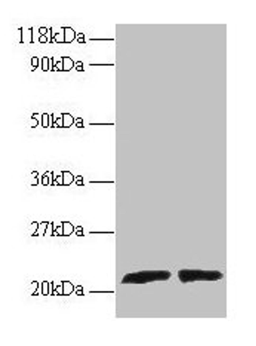 Western blot. All lanes: ARL2 antibody at 2µg/ml. Lane 1: EC109 whole cell lysate. Lane 2: 293T whole cell lysate. Secondary. Goat polyclonal to rabbit IgG at 1/15000 dilution. Predicted band size: 21, 19 kDa. Observed band size: 21 kDa