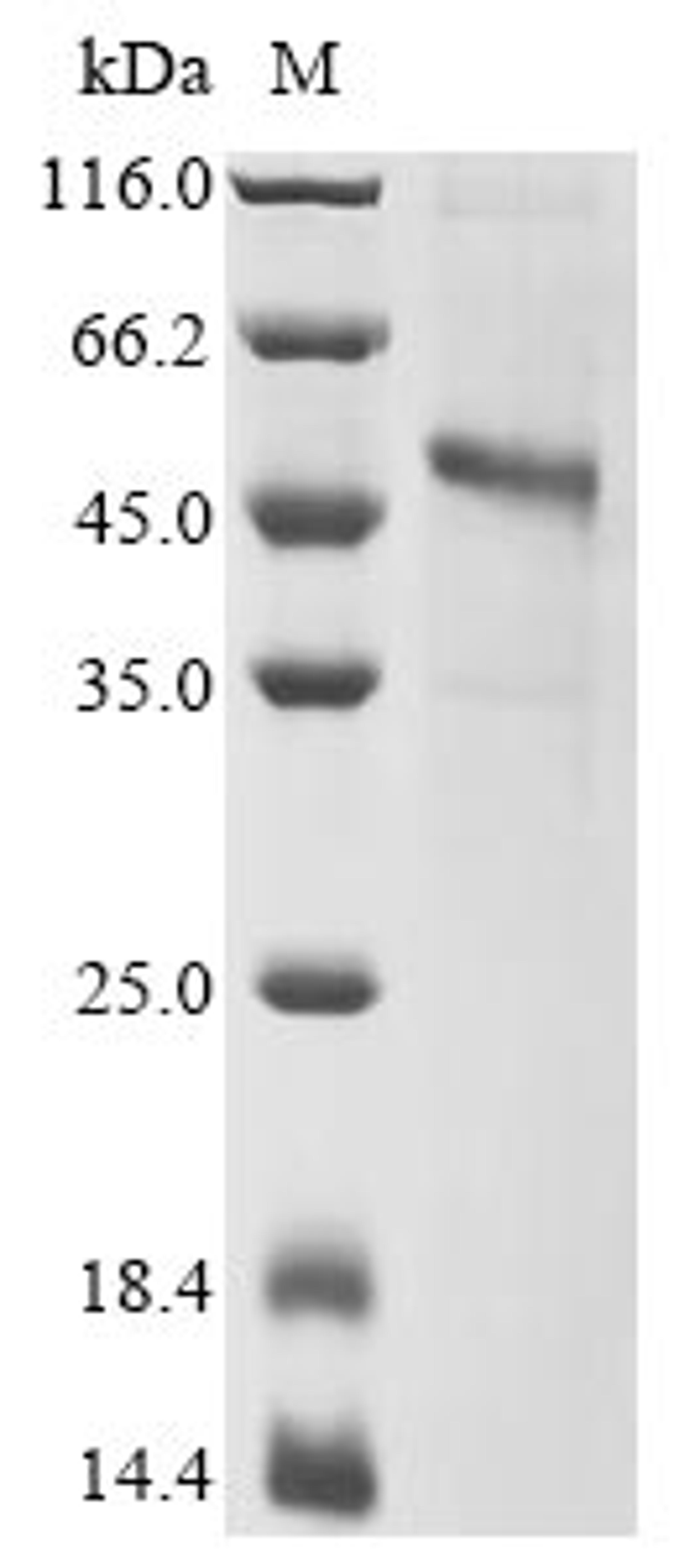 (Tris-Glycine gel) Discontinuous SDS-PAGE (reduced) with 5% enrichment gel and 15% separation gel.
