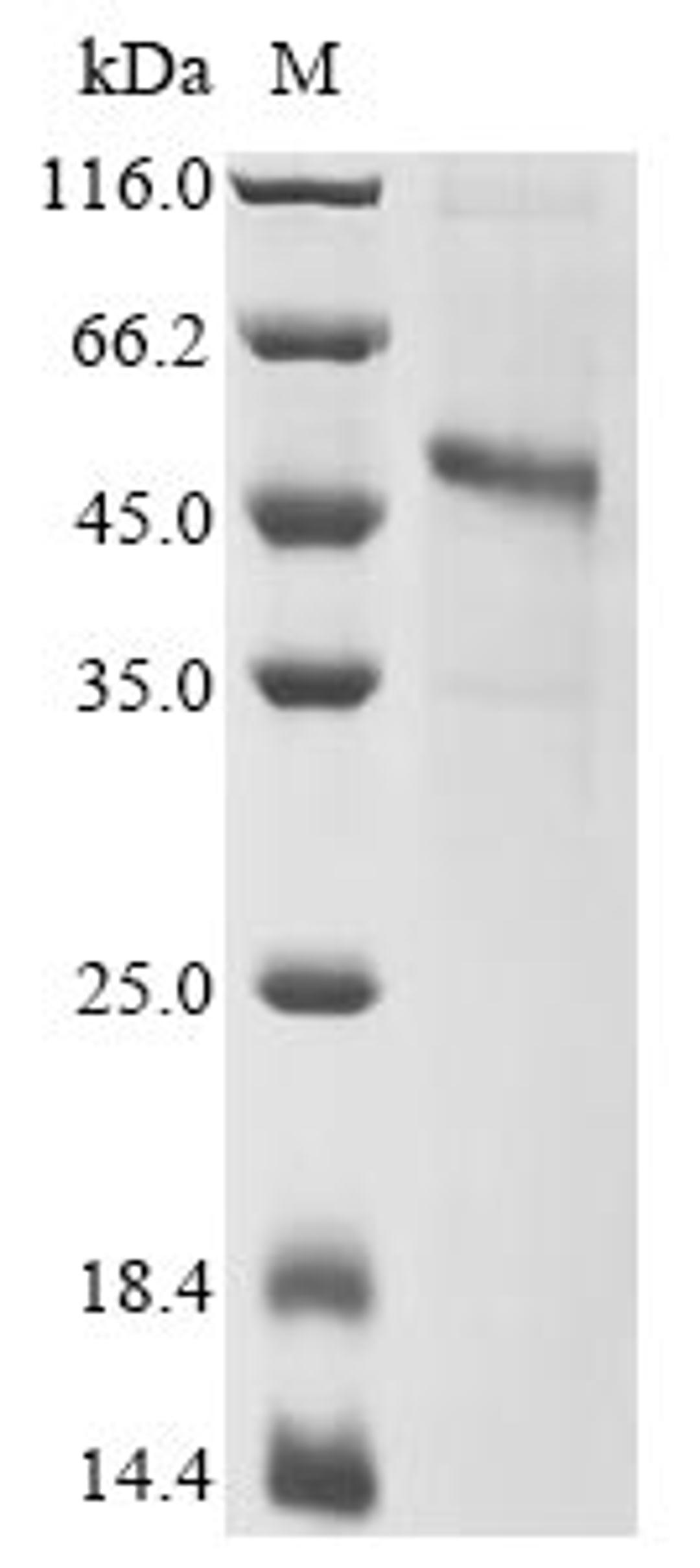 (Tris-Glycine gel) Discontinuous SDS-PAGE (reduced) with 5% enrichment gel and 15% separation gel.
