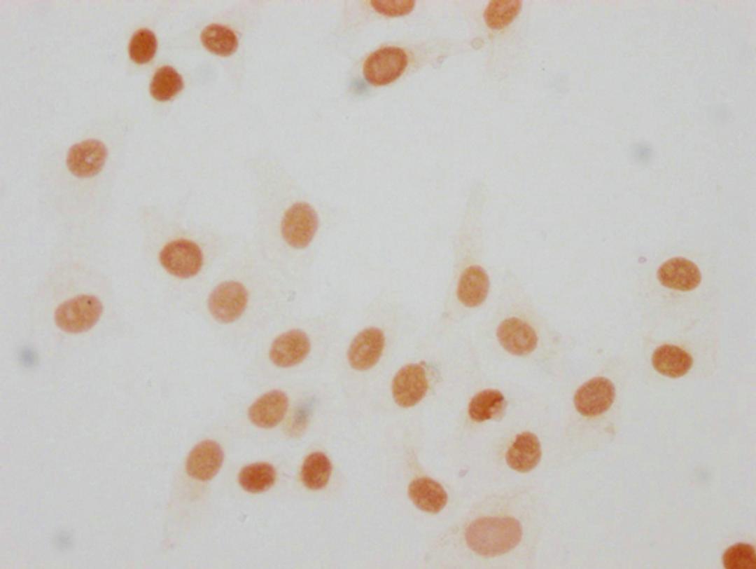 Immunocytochemistry analysis of CSB-PA010380OA63me1HU diluted at 1:30 and staining in Hela cells performed on a Leica BondTM system. The cells were fixed in 4% formaldehyde, permeabilized using 0.2% Triton X-100 and blocked with 10% normal goat serum 30min at RT. Then primary antibody (1% BSA) was incubated at 4°C overnight. The primary is detected by a biotinylated secondary antibody and visualized using an HRP conjugated SP system.