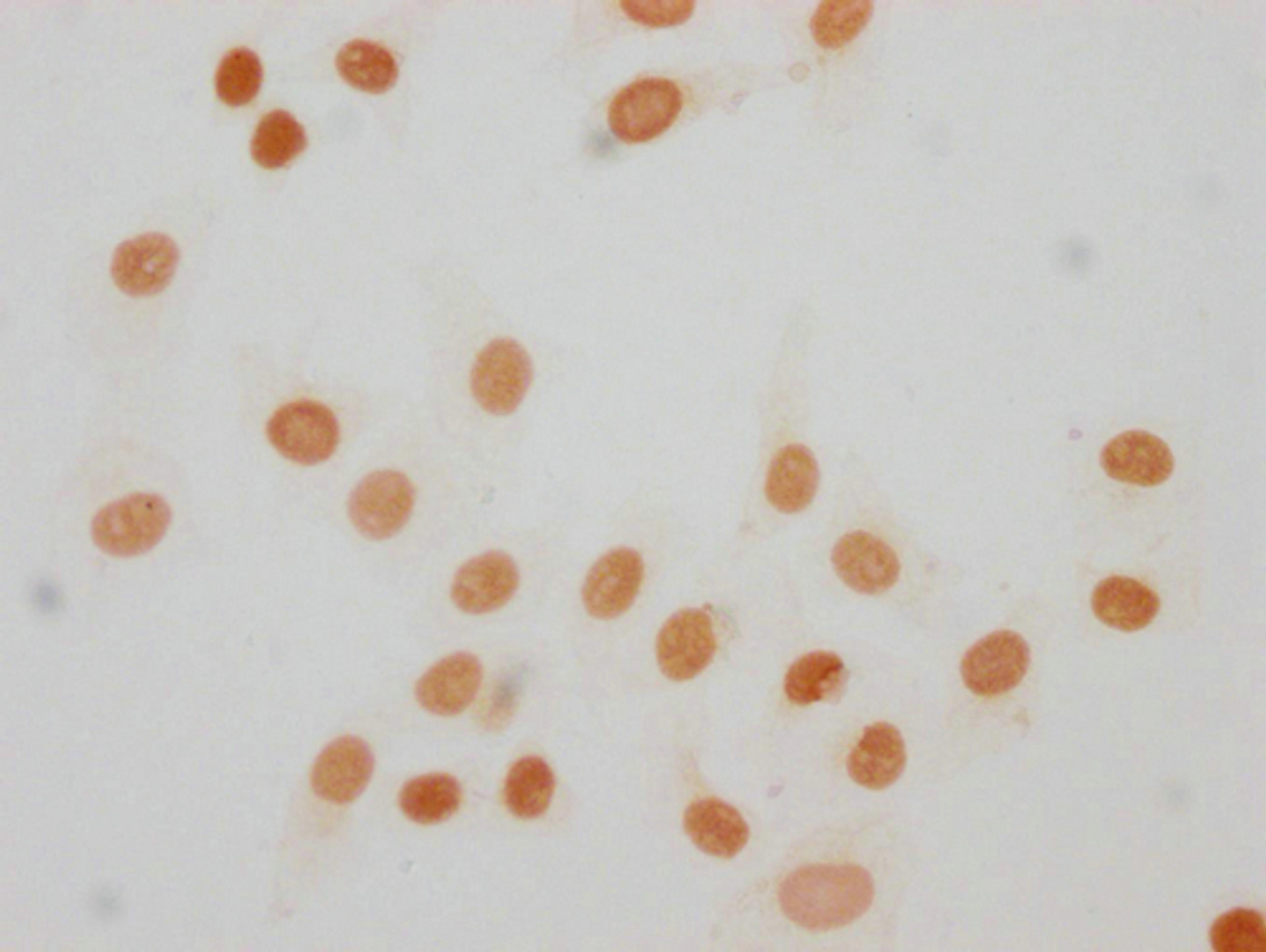 Immunocytochemistry analysis of CSB-PA010380OA63me1HU diluted at 1:30 and staining in Hela cells performed on a Leica BondTM system. The cells were fixed in 4% formaldehyde, permeabilized using 0.2% Triton X-100 and blocked with 10% normal goat serum 30min at RT. Then primary antibody (1% BSA) was incubated at 4°C overnight. The primary is detected by a biotinylated secondary antibody and visualized using an HRP conjugated SP system.