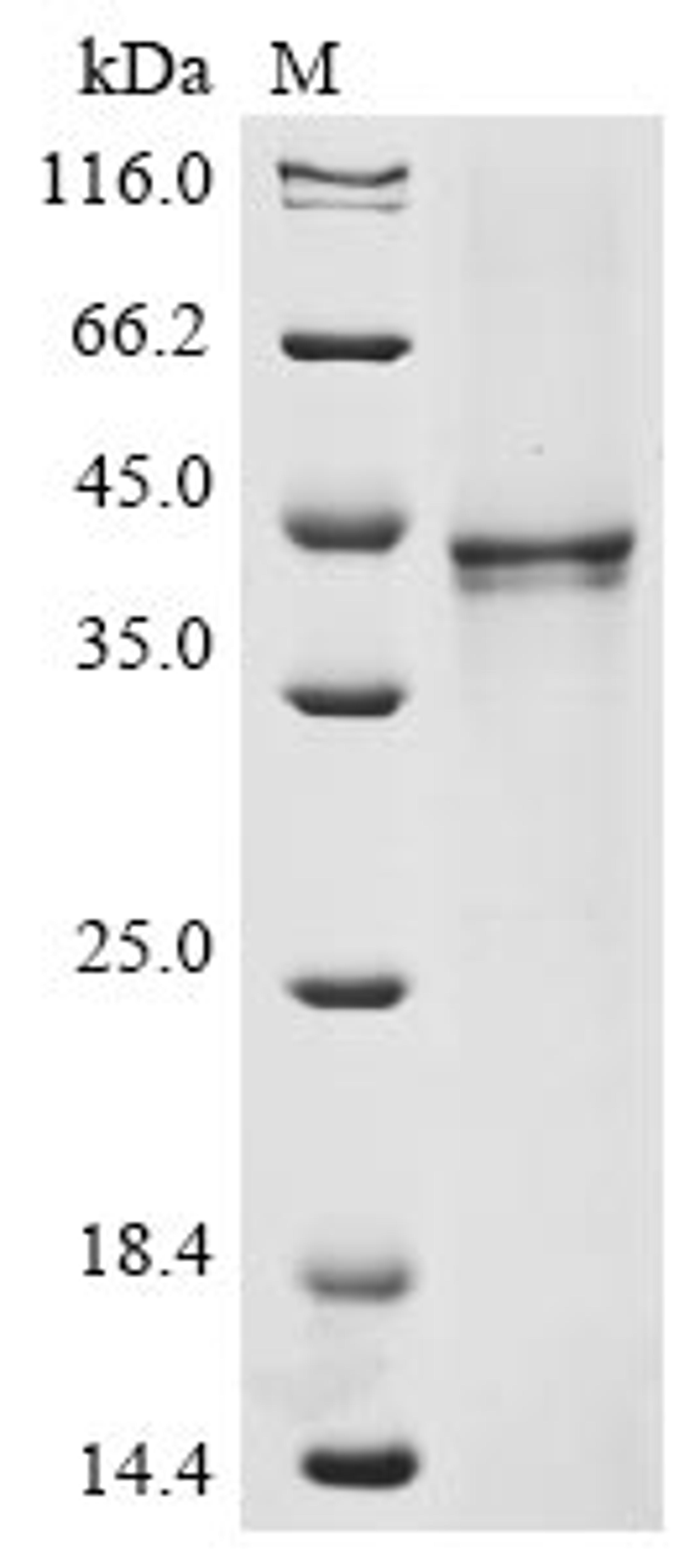 (Tris-Glycine gel) Discontinuous SDS-PAGE (reduced) with 5% enrichment gel and 15% separation gel.