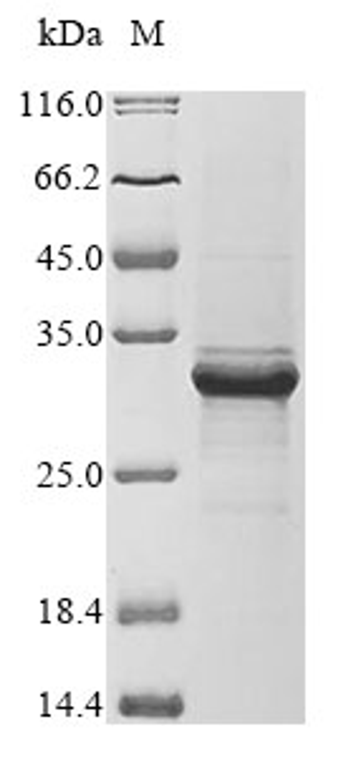 (Tris-Glycine gel) Discontinuous SDS-PAGE (reduced) with 5% enrichment gel and 15% separation gel.