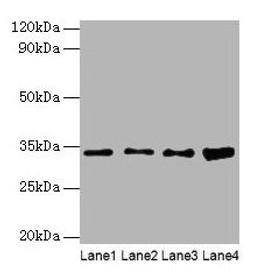 Western blot. All lanes: GTF2E2 antibody at 2µg/ml. Lane 1: Mouse brain tissue. Lane 2: Hela whole cell lysate. Lane 3: MCF-7 whole cell lysate. Lane 4: PC-3 whole cell lysate. Secondary. Goat polyclonal to rabbit IgG at 1/10000 dilution. Predicted band size: 34 kDa. Observed band size: 34 kDa