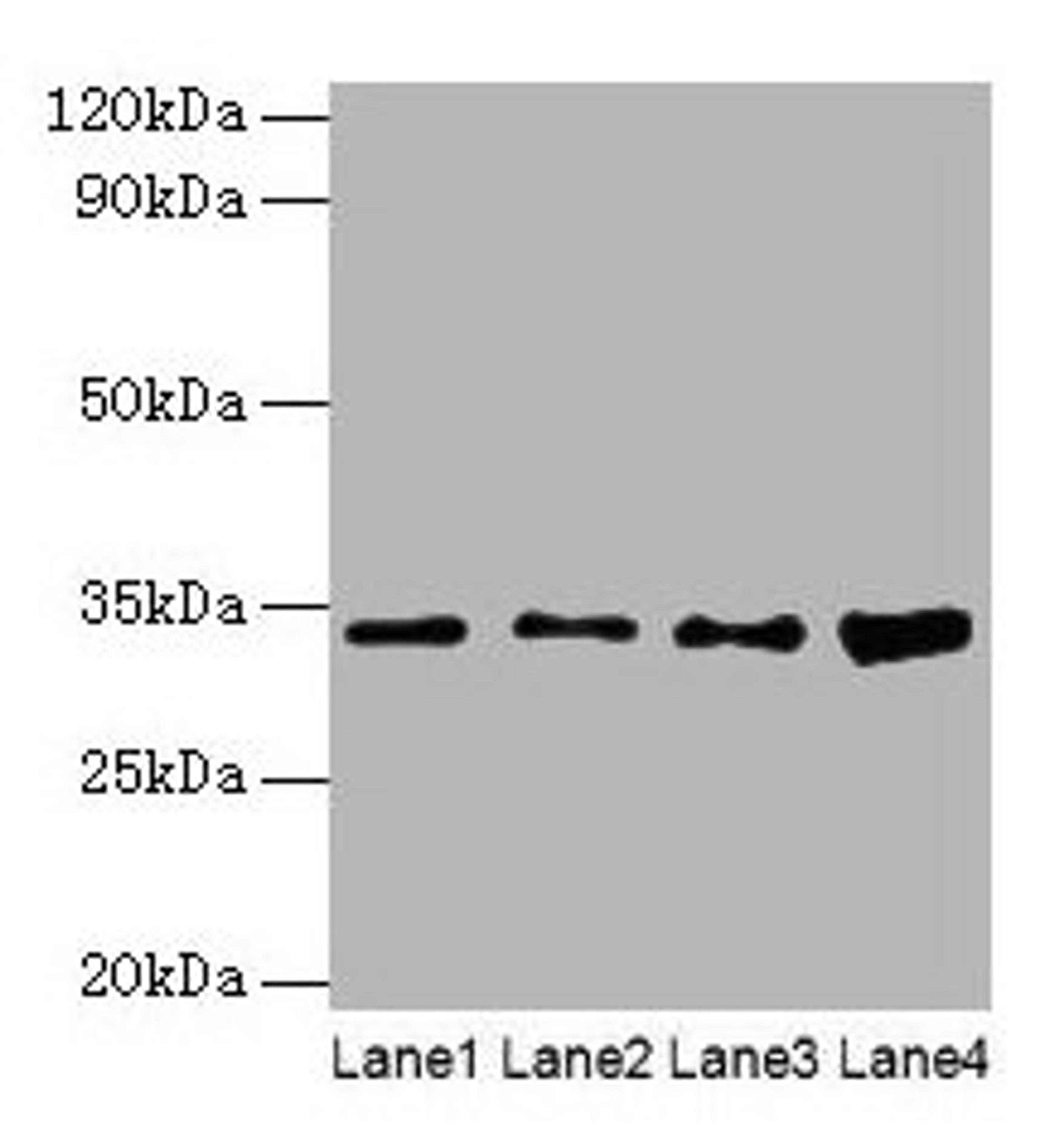 Western blot. All lanes: GTF2E2 antibody at 2µg/ml. Lane 1: Mouse brain tissue. Lane 2: Hela whole cell lysate. Lane 3: MCF-7 whole cell lysate. Lane 4: PC-3 whole cell lysate. Secondary. Goat polyclonal to rabbit IgG at 1/10000 dilution. Predicted band size: 34 kDa. Observed band size: 34 kDa