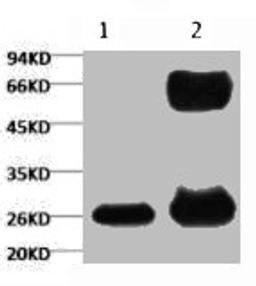 1) Input (control)  2) IP products, antibody dilution 1:200