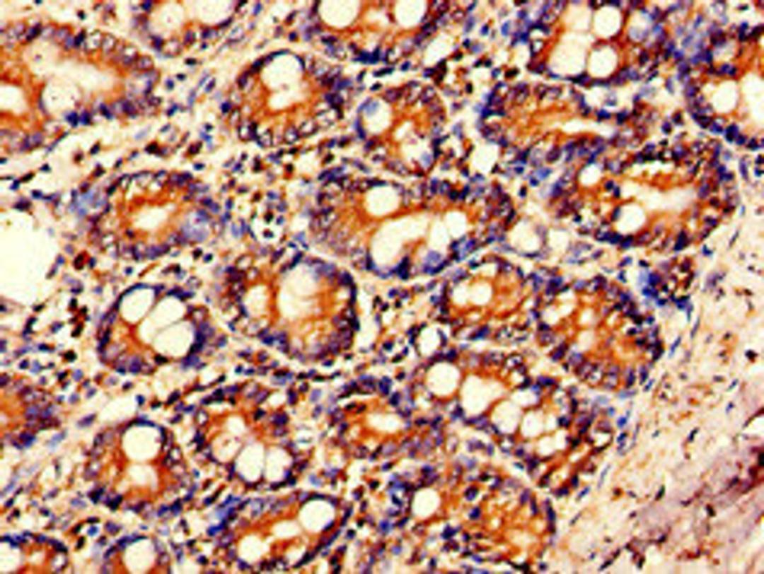 Immunohistochemistry of paraffin-embedded human small intestine tissue using CSB-PA06719A0Rb at dilution of 1:100
