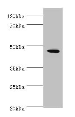 Western blot. All lanes: STK32A antibody at 2µg/ml + MCF-7 whole cell lysate. Secondary. Goat polyclonal to rabbit IgG at 1/10000 dilution. Predicted band size: 47, 20, 42 kDa. Observed band size: 47 kDa