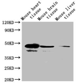 Western Blot. Positive WB detected in: Mouse brain tissue, Mouse skeletal muscle tissue. All lanes: SEPP1 antibody at 4ug/ml. Secondary. Goat polyclonal to rabbit IgG at 1/50000 dilution. Predicted band size: 43 kDa. Observed band size: 43, 40 kDa. 