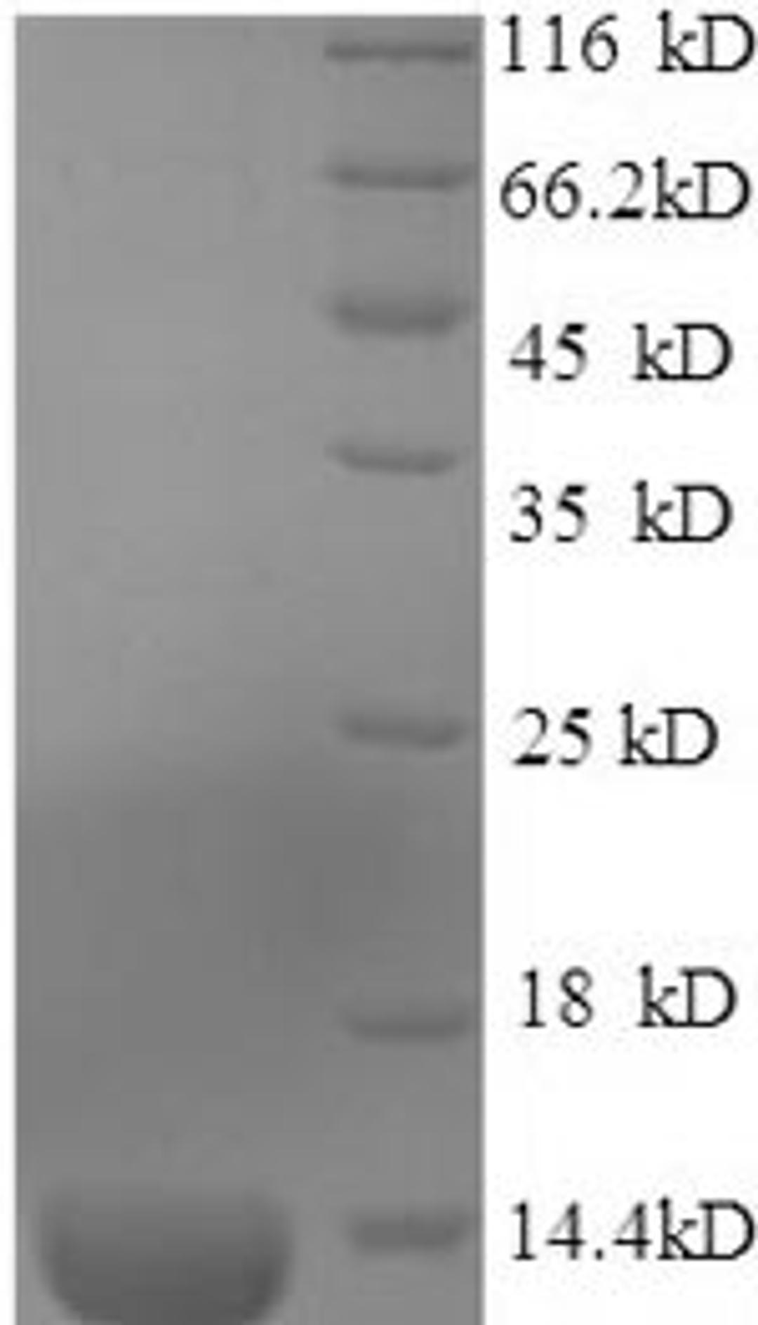 (Tris-Glycine gel) Discontinuous SDS-PAGE (reduced) with 5% enrichment gel and 15% separation gel.