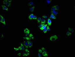Immunofluorescence staining of PC-3 cells with CSB-PA022621LA01HU at 1:266, counter-stained with DAPI. The cells were fixed in 4% formaldehyde, permeabilized using 0.2% Triton X-100 and blocked in 10% normal Goat Serum. The cells were then incubated with the antibody overnight at 4&deg;C. The secondary antibody was Alexa Fluor 488-congugated AffiniPure Goat Anti-Rabbit IgG(H+L).