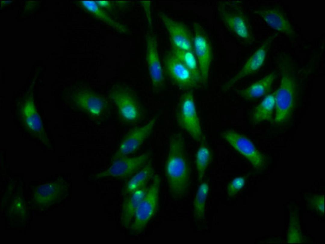 Immunofluorescence staining of Hela cells with CSB-PA001461LA01HU at 1:133, counter-stained with DAPI. The cells were fixed in 4% formaldehyde, permeabilized using 0.2% Triton X-100 and blocked in 10% normal Goat Serum. The cells were then incubated with the antibody overnight at 4&deg;C. The secondary antibody was Alexa Fluor 488-congugated AffiniPure Goat Anti-Rabbit IgG(H+L).