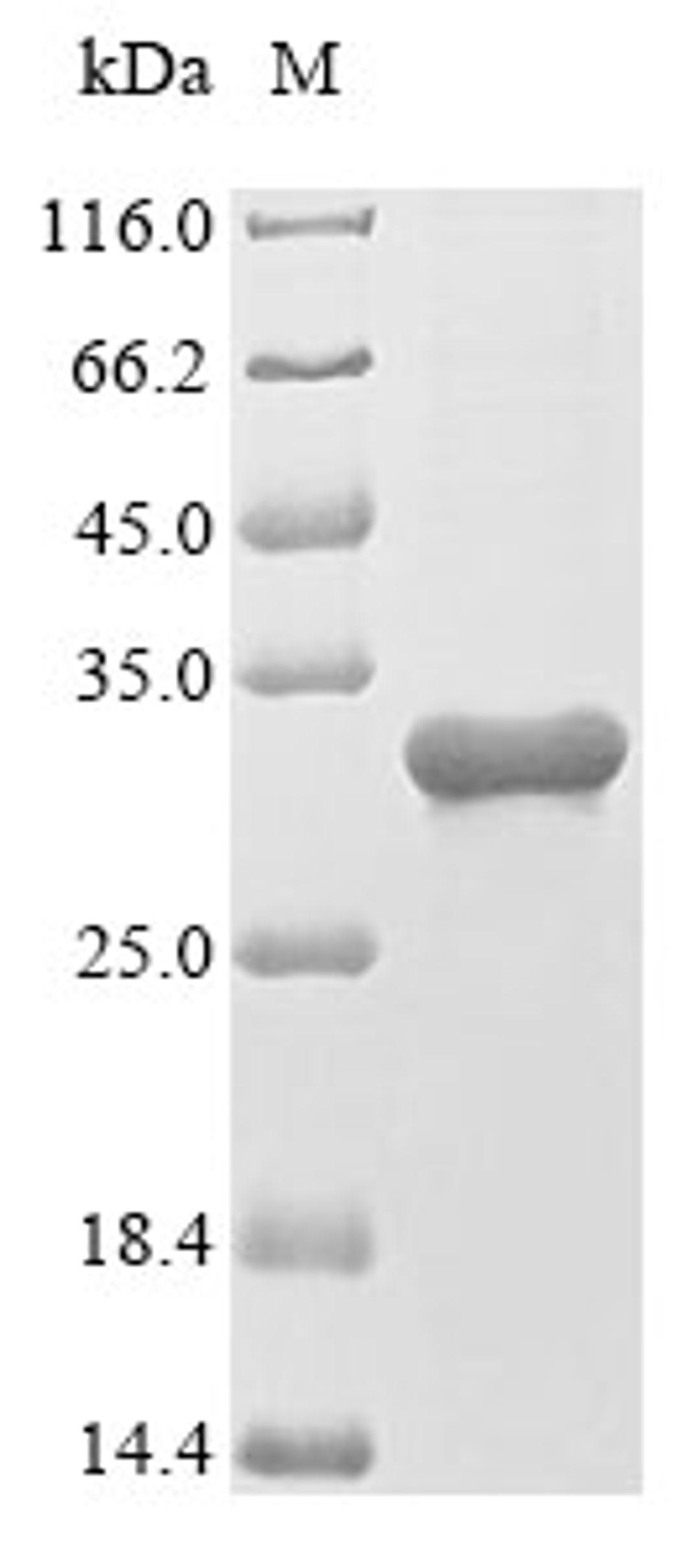 (Tris-Glycine gel) Discontinuous SDS-PAGE (reduced) with 5% enrichment gel and 15% separation gel.