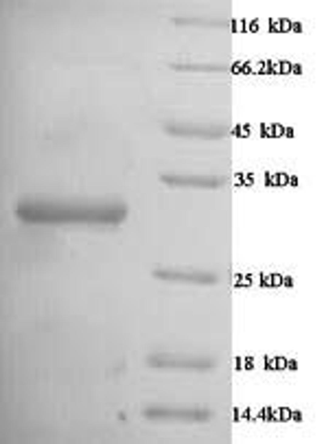 (Tris-Glycine gel) Discontinuous SDS-PAGE (reduced) with 5% enrichment gel and 15% separation gel.