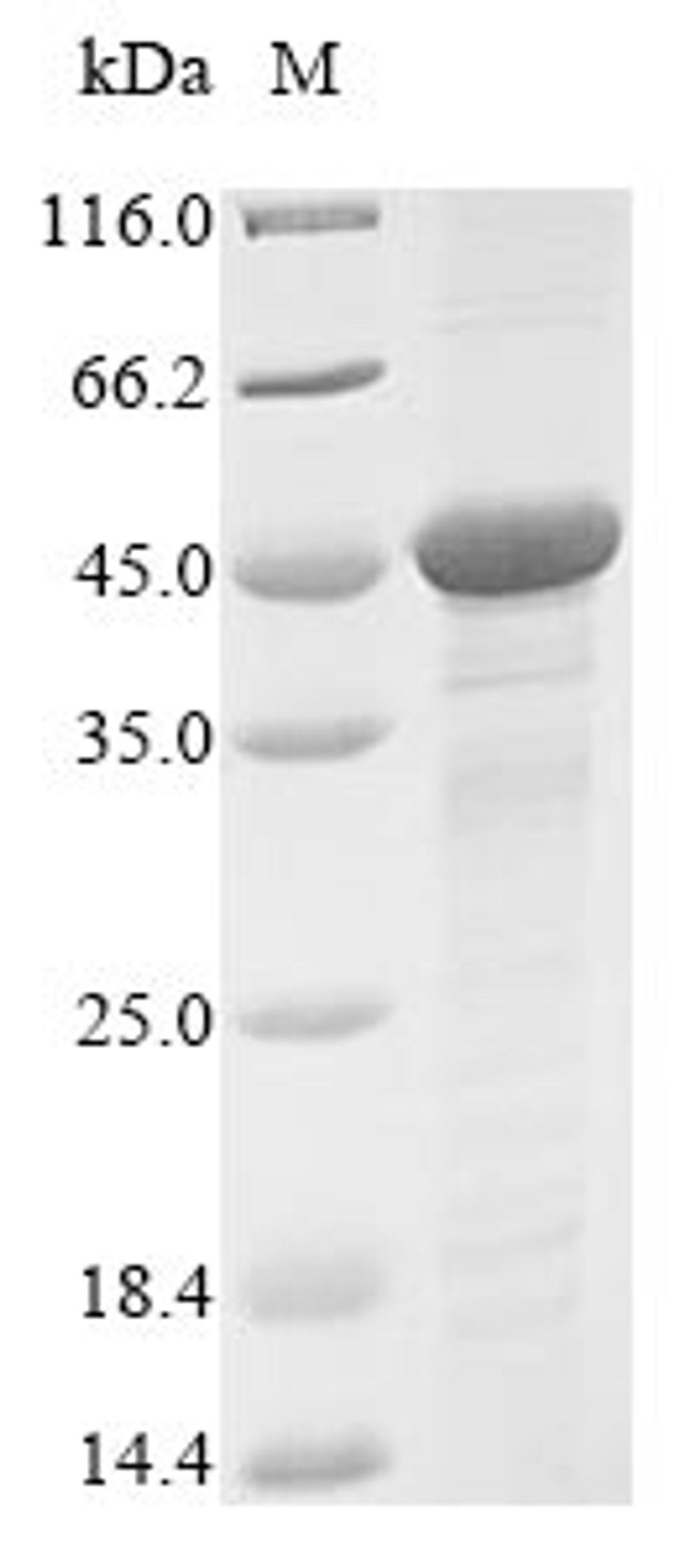 (Tris-Glycine gel) Discontinuous SDS-PAGE (reduced) with 5% enrichment gel and 15% separation gel.