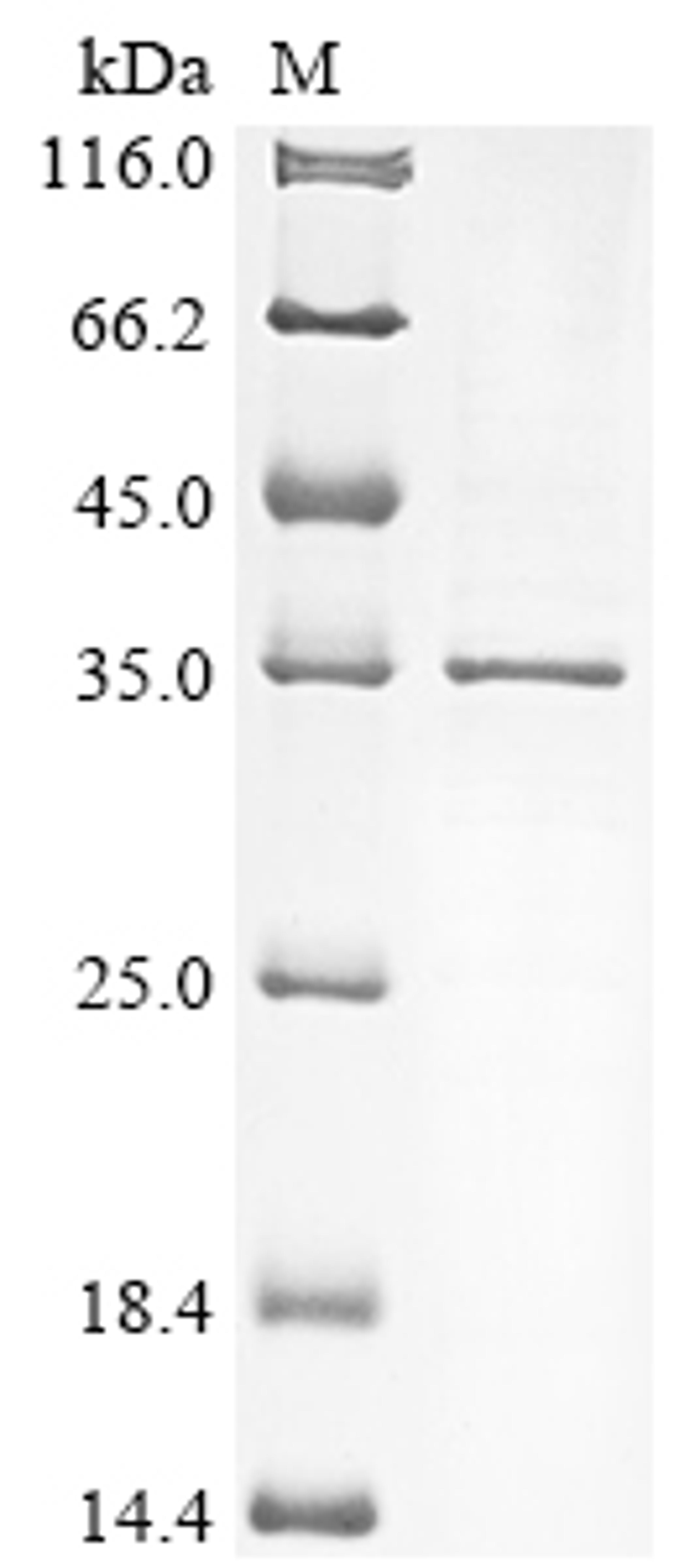 (Tris-Glycine gel) Discontinuous SDS-PAGE (reduced) with 5% enrichment gel and 15% separation gel.