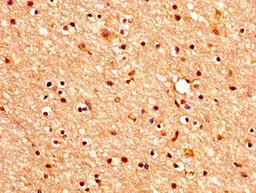 IHC image of CSB-PA005383LA01HU diluted at 1:400 and staining in paraffin-embedded human brain tissue performed on a Leica BondTM system. After dewaxing and hydration, antigen retrieval was mediated by high pressure in a citrate buffer (pH 6.0). Section was blocked with 10% normal goat serum 30min at RT. Then primary antibody (1% BSA) was incubated at 4&deg;C overnight. The primary is detected by a biotinylated secondary antibody and visualized using an HRP conjugated SP system.