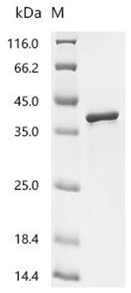 (Tris-Glycine gel) Discontinuous SDS-PAGE (reduced) with 5% enrichment gel and 15% separation gel.