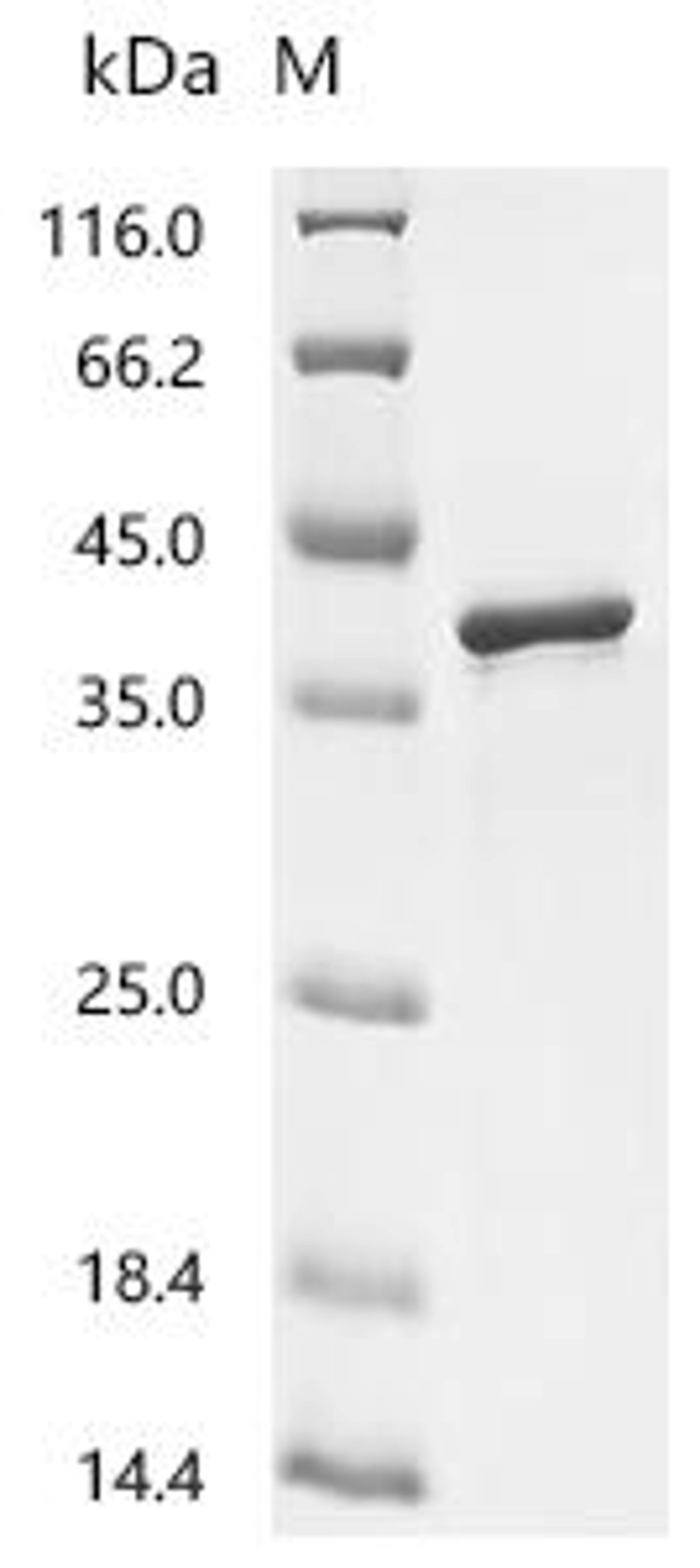 (Tris-Glycine gel) Discontinuous SDS-PAGE (reduced) with 5% enrichment gel and 15% separation gel.