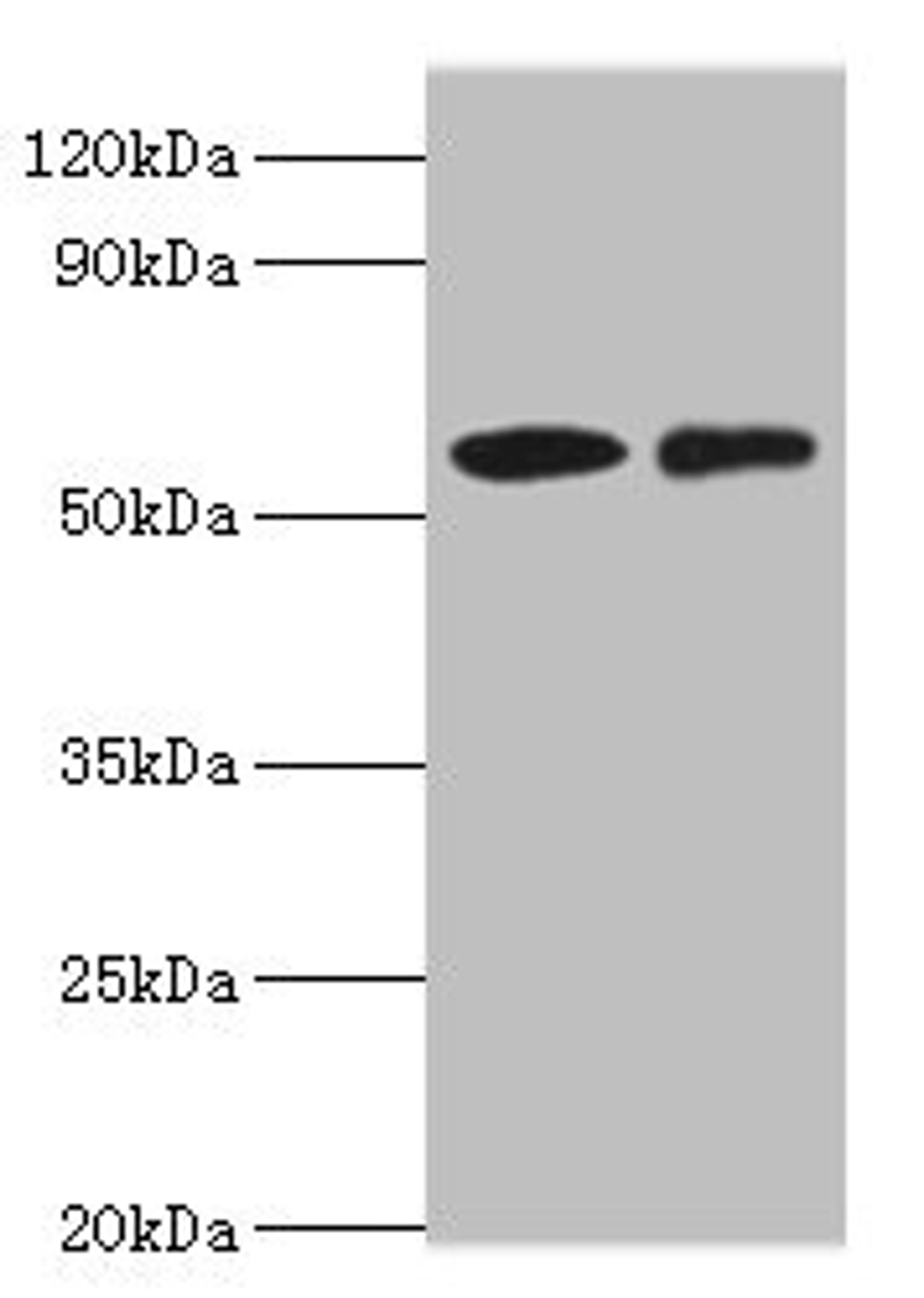 Western blot. All lanes: CARD9 antibody at 15ug/ml. Lane 1: THP-1 whole cell lysate. Lane 2: Jurkat whole cell lysate. Secondary. Goat polyclonal to rabbit IgG at 1/10000 dilution. Predicted band size: 63, 57, 43 kDa. Observed band size: 63 kDa. 