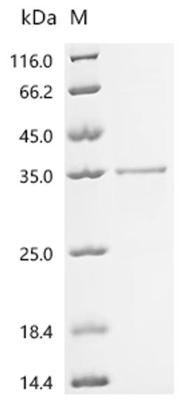 (Tris-Glycine gel) Discontinuous SDS-PAGE (reduced) with 5% enrichment gel and 15% separation gel.
