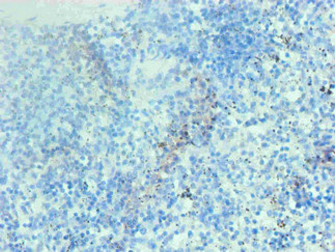Immunohistochemical of paraffin-embedded human spleen tissue using CSB-MA002401E0m at dilution of 1:200