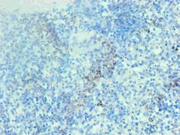Immunohistochemical of paraffin-embedded human spleen tissue using CSB-MA002401E0m at dilution of 1:200
