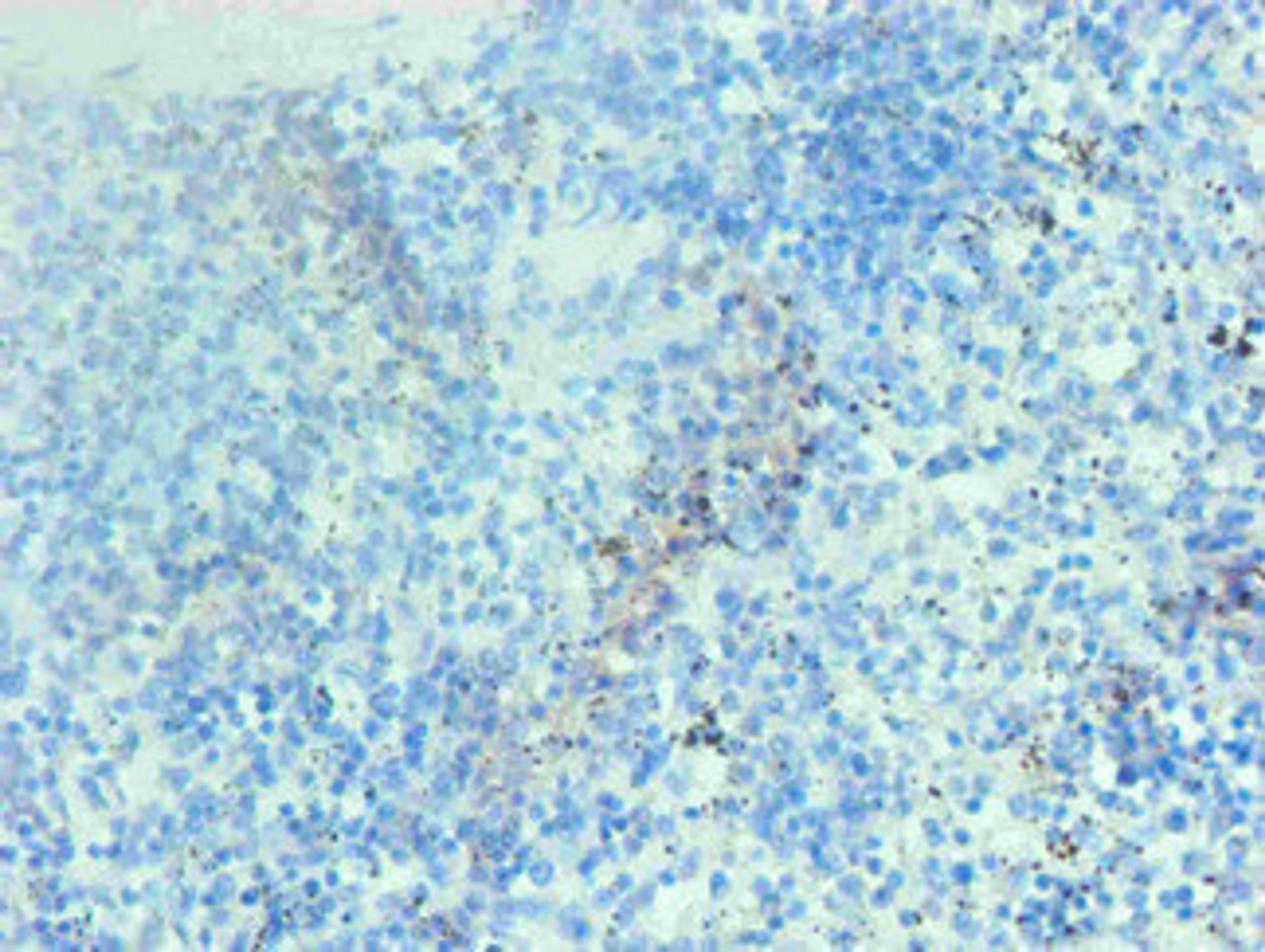 Immunohistochemical of paraffin-embedded human spleen tissue using CSB-MA002401E0m at dilution of 1:200