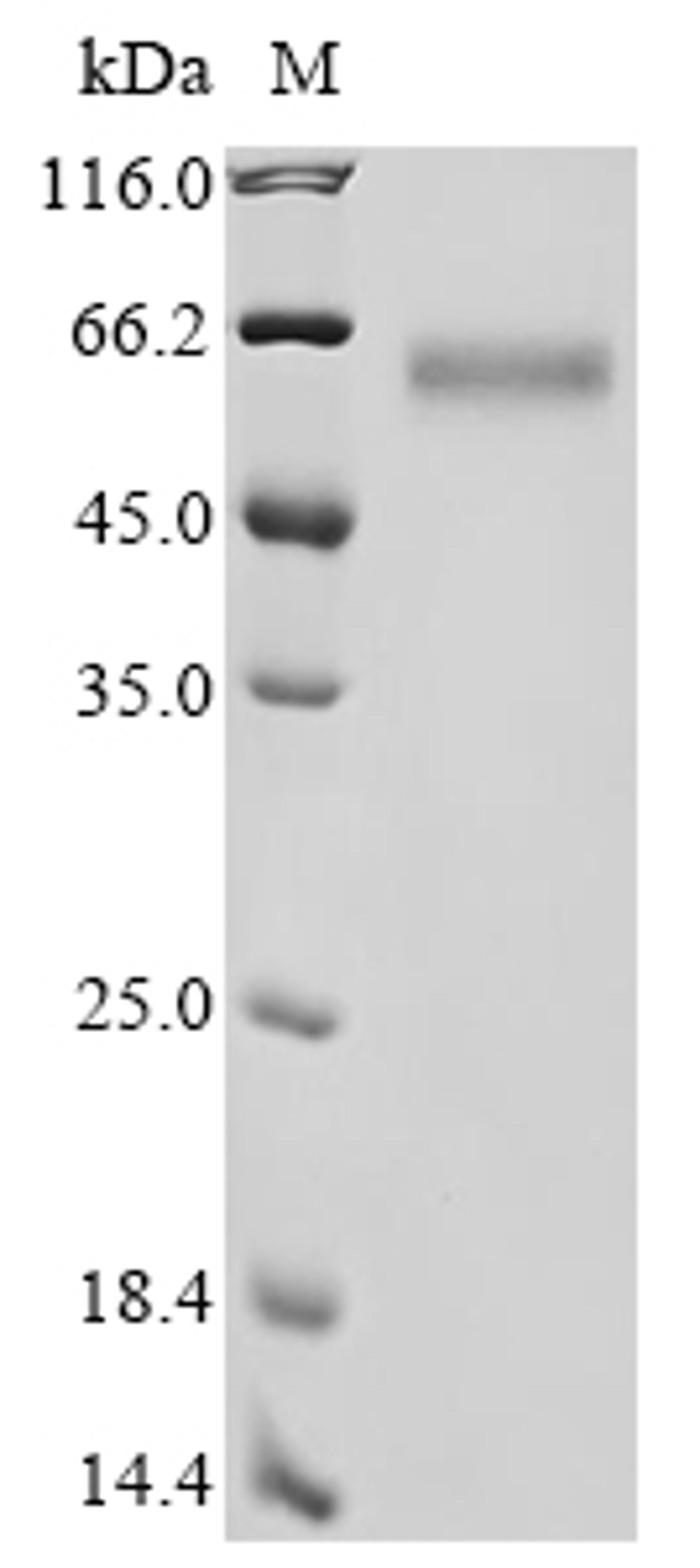 (Tris-Glycine gel) Discontinuous SDS-PAGE (reduced) with 5% enrichment gel and 15% separation gel.