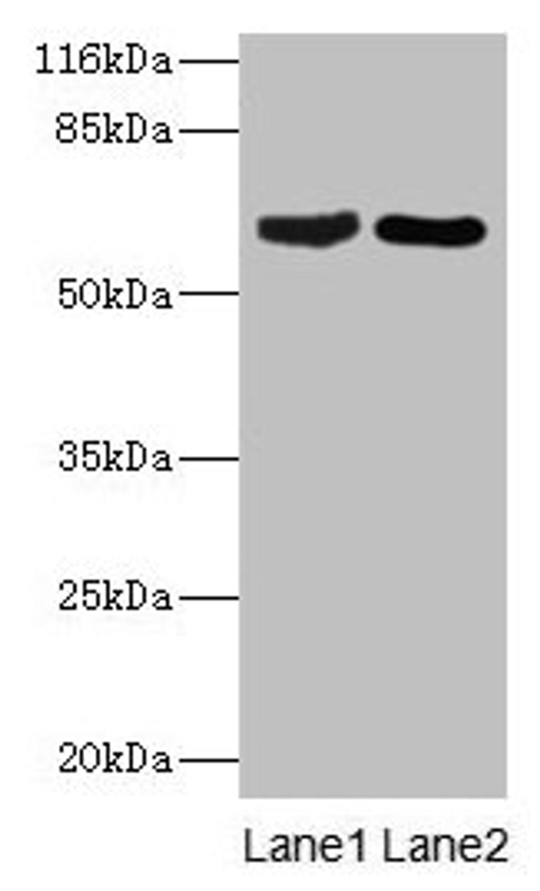 Western blot. All lanes: CRMP1 antibody at 2µg/ml. Lane 1: Rat brain tissue. Lane 2: Mouse lung tissue. Secondary. Goat polyclonal to rabbit IgG at 1/10000 dilution. Predicted band size: 63, 75 kDa. Observed band size: 63 kDa