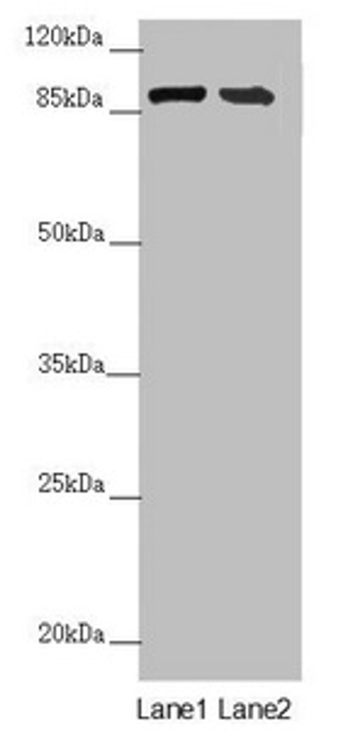 Western blot. All lanes: CEP95 antibody at 6.06 ug/ml. Lane 1: Mouse heart tissue. Lane 2: Mouse kidney tissue. Secondary. Goat polyclonal to rabbit IgG at 1/10000 dilution. Predicted band size: 96, 77 kDa. Observed band size: 96 kDa. 