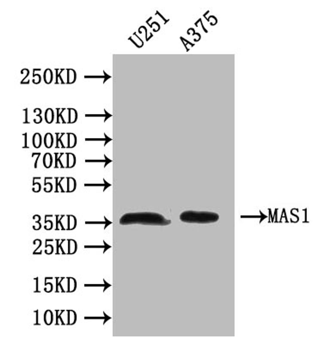 Western Blot. Positive WB detected in: Mouse Brain tissue. All lanes: MAS1 antibody at 1:2000. Secondary. Goat polyclonal to rabbit IgG at 1/50000 dilution. Predicted band size: 38 kDa. Observed band size: 38 kDa. 