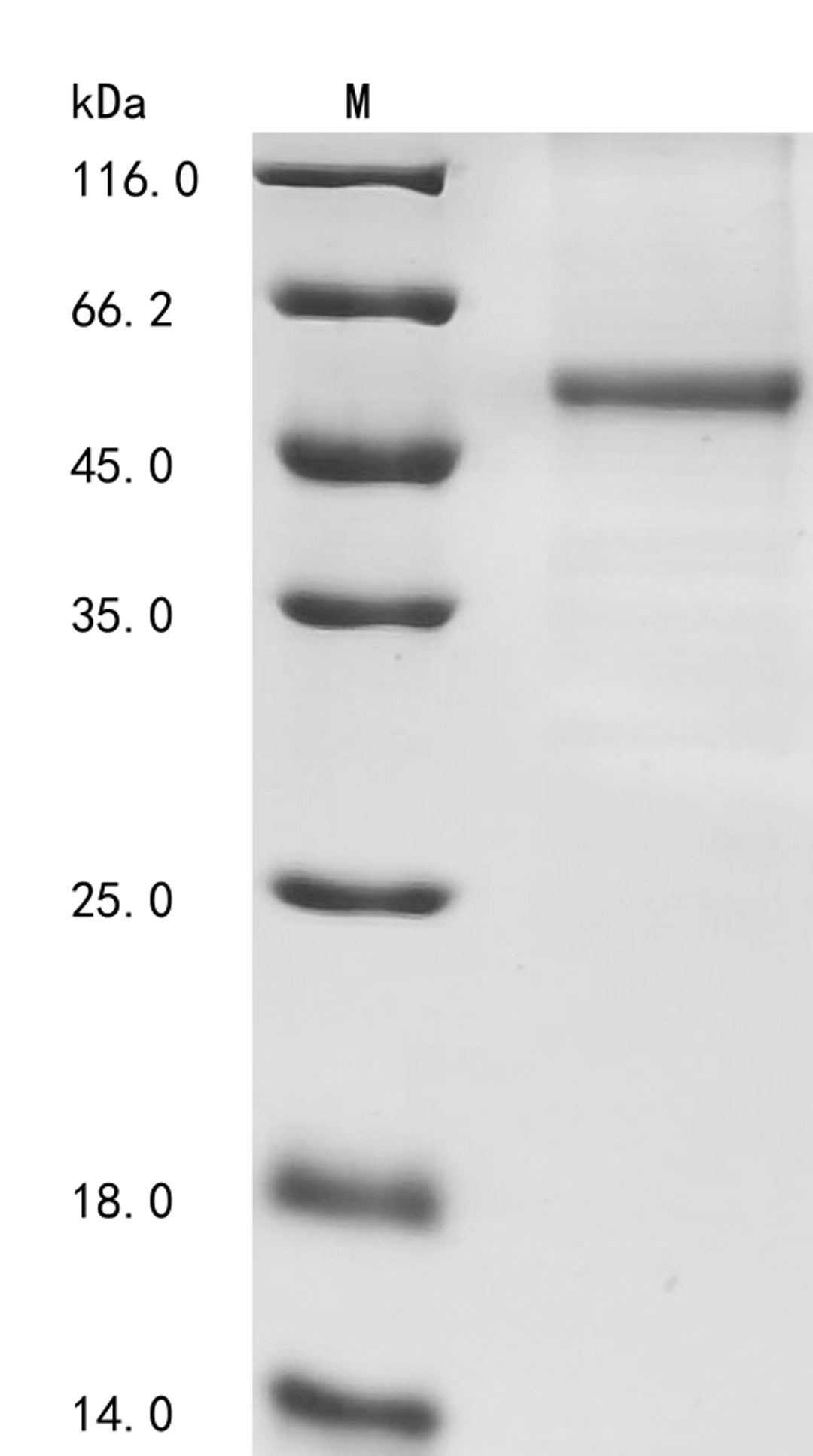 (Tris-Glycine gel) Discontinuous SDS-PAGE (reduced) with 5% enrichment gel and 15% separation gel.