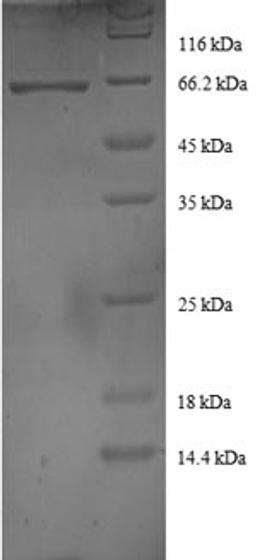 (Tris-Glycine gel) Discontinuous SDS-PAGE (reduced) with 5% enrichment gel and 15% separation gel.