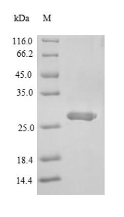 (Tris-Glycine gel) Discontinuous SDS-PAGE (reduced) with 5% enrichment gel and 15% separation gel.