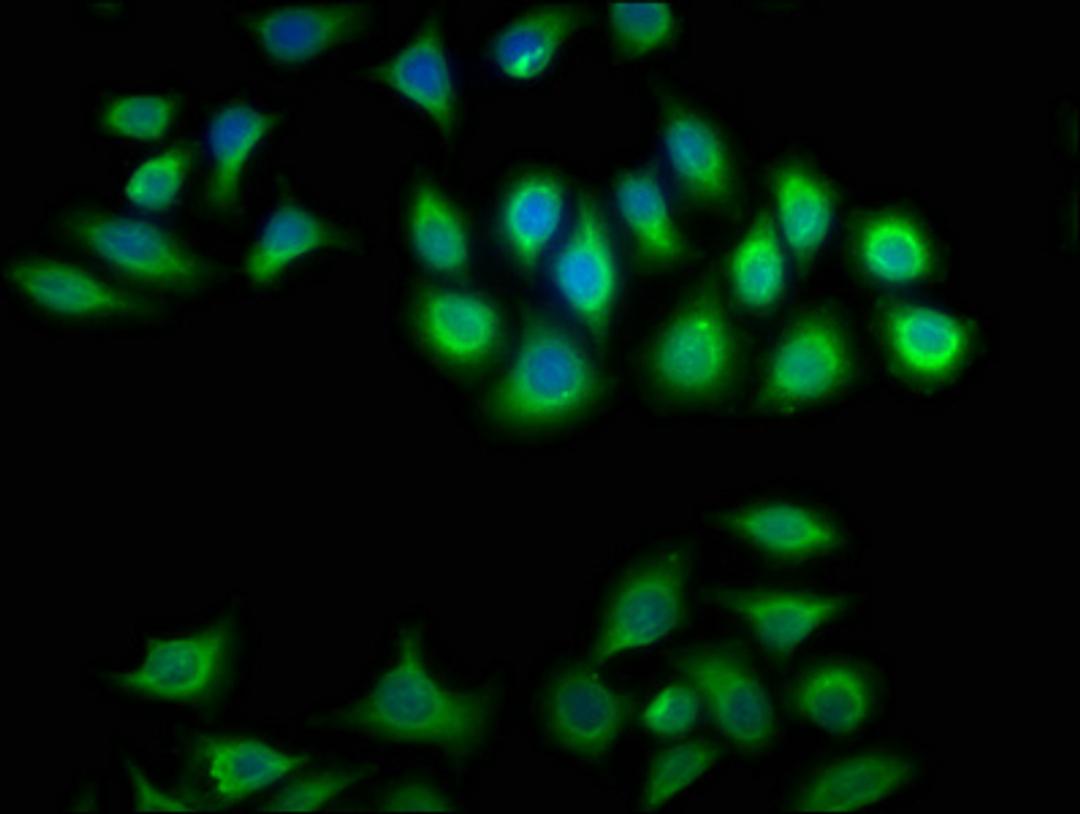 Immunofluorescence staining of A549 cells with CSB-PA006009LA01HU at 1:100, counter-stained with DAPI. The cells were fixed in 4% formaldehyde, permeabilized using 0.2% Triton X-100 and blocked in 10% normal Goat Serum. The cells were then incubated with the antibody overnight at 4°C. The secondary antibody was Alexa Fluor 488-congugated AffiniPure Goat Anti-Rabbit IgG(H+L).
