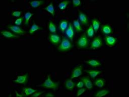 Immunofluorescence staining of A549 cells with CSB-PA006009LA01HU at 1:100, counter-stained with DAPI. The cells were fixed in 4% formaldehyde, permeabilized using 0.2% Triton X-100 and blocked in 10% normal Goat Serum. The cells were then incubated with the antibody overnight at 4°C. The secondary antibody was Alexa Fluor 488-congugated AffiniPure Goat Anti-Rabbit IgG(H+L).