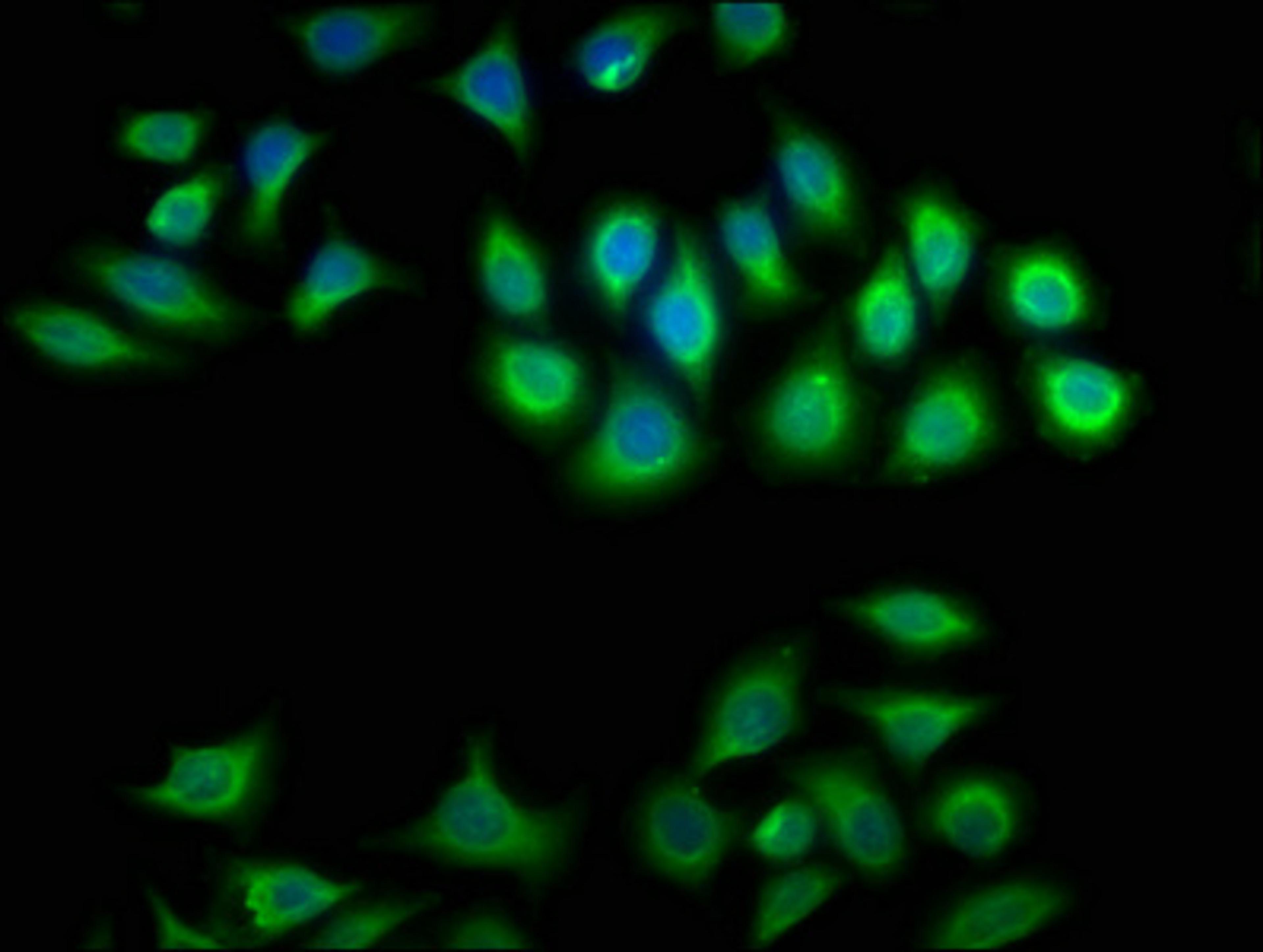 Immunofluorescence staining of A549 cells with CSB-PA006009LA01HU at 1:100, counter-stained with DAPI. The cells were fixed in 4% formaldehyde, permeabilized using 0.2% Triton X-100 and blocked in 10% normal Goat Serum. The cells were then incubated with the antibody overnight at 4°C. The secondary antibody was Alexa Fluor 488-congugated AffiniPure Goat Anti-Rabbit IgG(H+L).