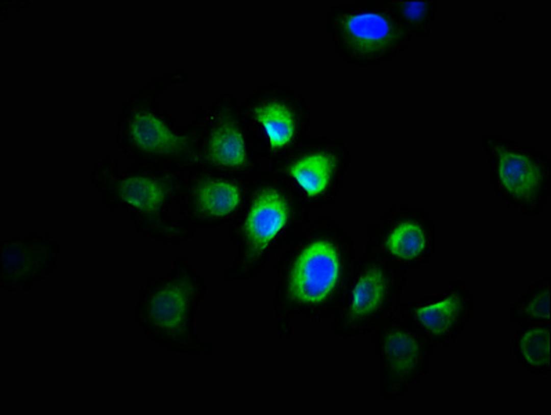 Immunofluorescence staining of A549 cells with CSB-PA03025A0Rb at 1:166, counter-stained with DAPI. The cells were fixed in 4% formaldehyde, permeabilized using 0.2% Triton X-100 and blocked in 10% normal Goat Serum. The cells were then incubated with the antibody overnight at 4&deg;C. The secondary antibody was Alexa Fluor 488-congugated AffiniPure Goat Anti-Rabbit IgG(H+L).