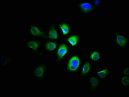 Immunofluorescence staining of A549 cells with CSB-PA03025A0Rb at 1:166, counter-stained with DAPI. The cells were fixed in 4% formaldehyde, permeabilized using 0.2% Triton X-100 and blocked in 10% normal Goat Serum. The cells were then incubated with the antibody overnight at 4&deg;C. The secondary antibody was Alexa Fluor 488-congugated AffiniPure Goat Anti-Rabbit IgG(H+L).