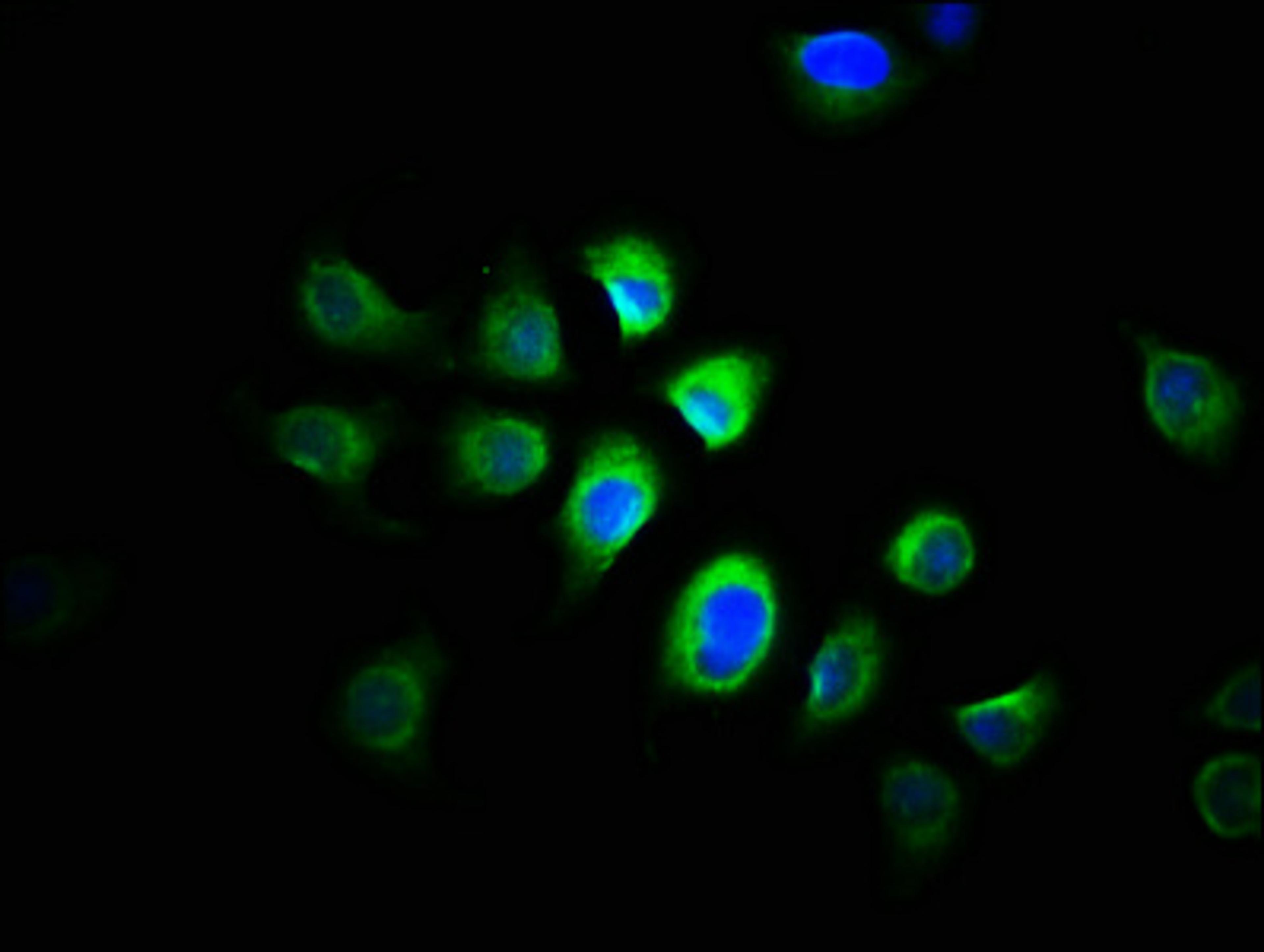 Immunofluorescence staining of A549 cells with CSB-PA03025A0Rb at 1:166, counter-stained with DAPI. The cells were fixed in 4% formaldehyde, permeabilized using 0.2% Triton X-100 and blocked in 10% normal Goat Serum. The cells were then incubated with the antibody overnight at 4&deg;C. The secondary antibody was Alexa Fluor 488-congugated AffiniPure Goat Anti-Rabbit IgG(H+L).