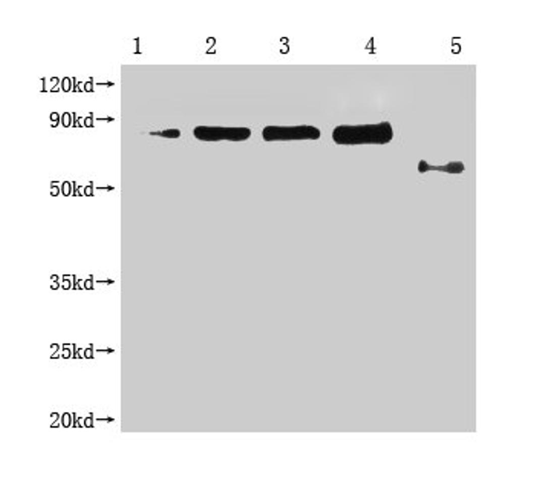 Western Blot. Positive WB detected in: 1-4 lanes: Recombinant Enterobacteria phage M13 Attachment protein at 2.5ng, 5ng, 10ng, 20ng; 5 lane: Enterobacteria phage M13 Attachment. All lanes: Enterobacteria phage M13 III antibody at 1:1000. Secondary. Goat polyclonal to mouse IgG at 1/50000 dilution. Predicted band size: 65, 55-70 KDa. Observed band size: 65, 55-70 KDa. Exposure time：3min