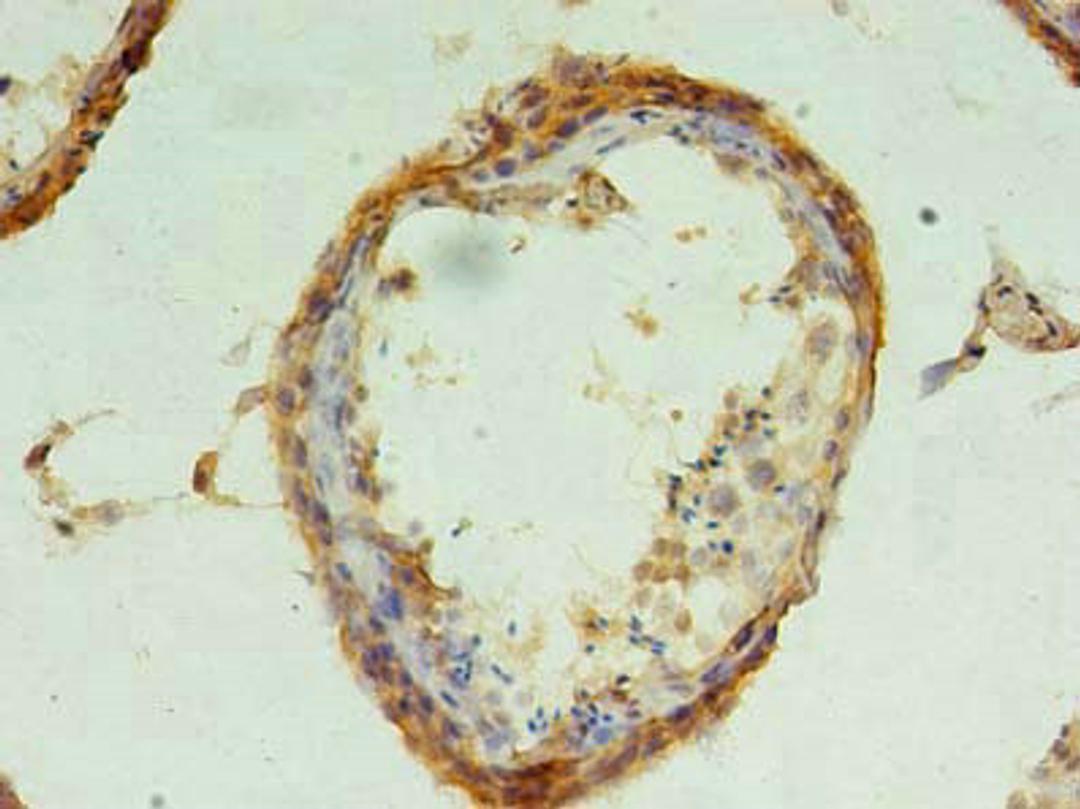 Immunohistochemistry of paraffin-embedded human testis tissue using CSB-PA846622LA01HU at dilution of 1:100